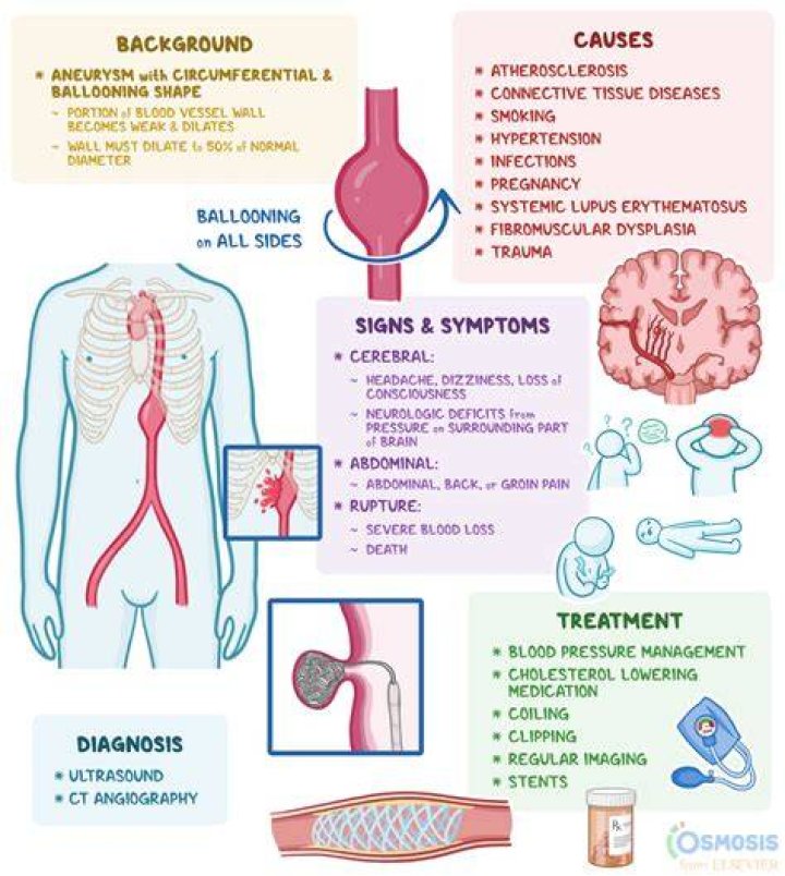 Can an aneurysm cause digestive problems?