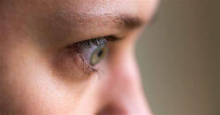 Can bulging eyes be corrected
