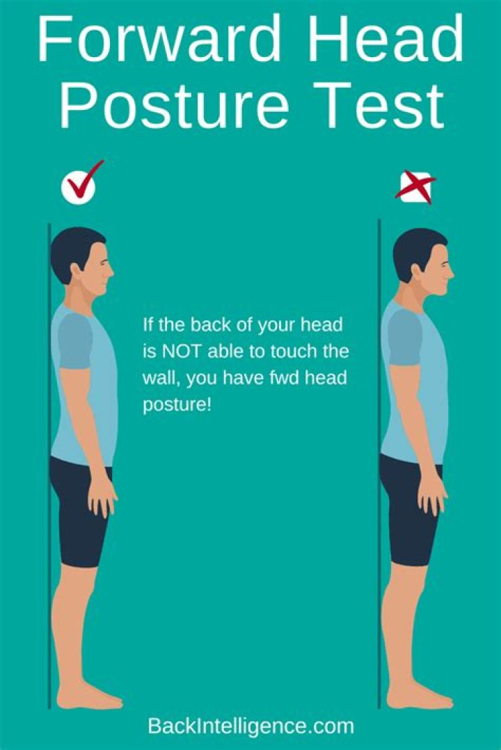 Can forward head posture be corrected?