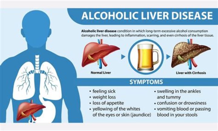 Does Shou Wu cause liver damage?