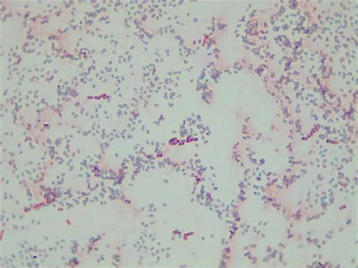 Does Staphylococcus epidermidis form endospores
