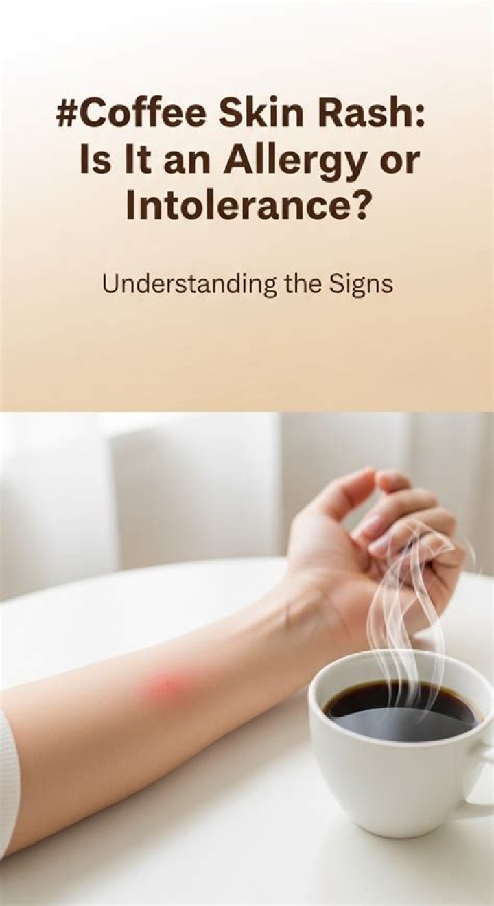 How common is a coffee allergy?