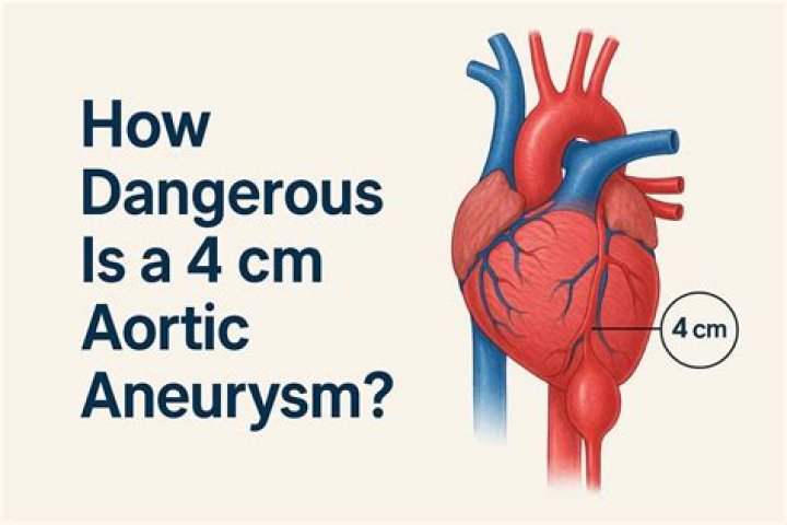 How dangerous is a myelogram