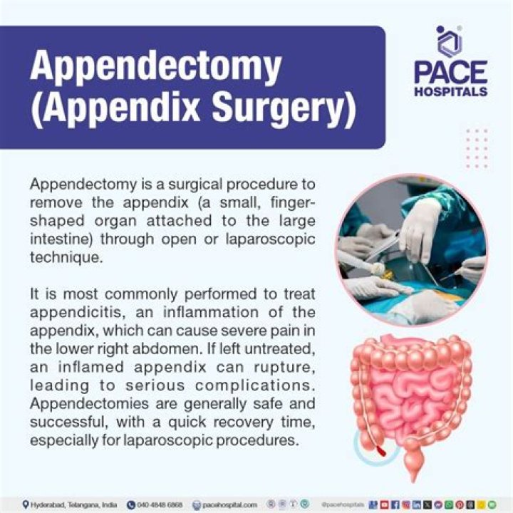 How do they perform an appendix surgery?