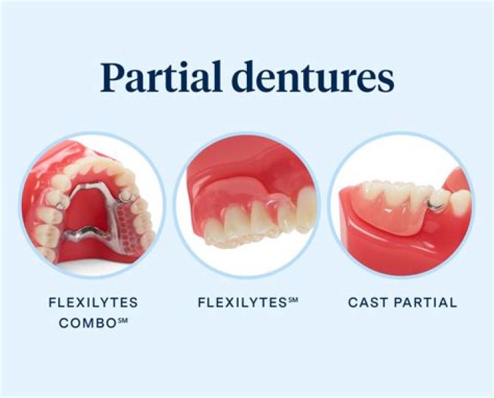 How do you do a partial view