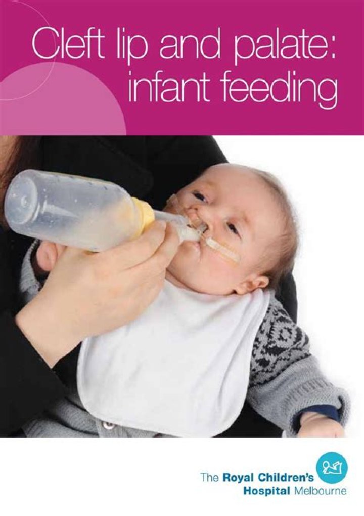 How do you feed with a cleft lip
