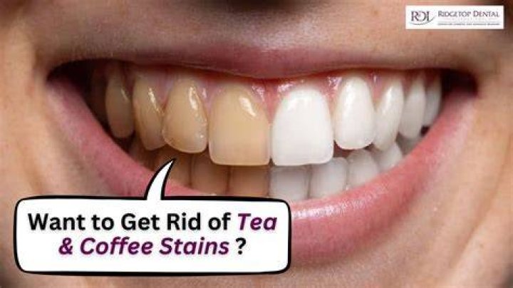 How do you keep tea from staining your teeth?