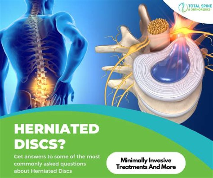 How do you rehydrate cervical discs?