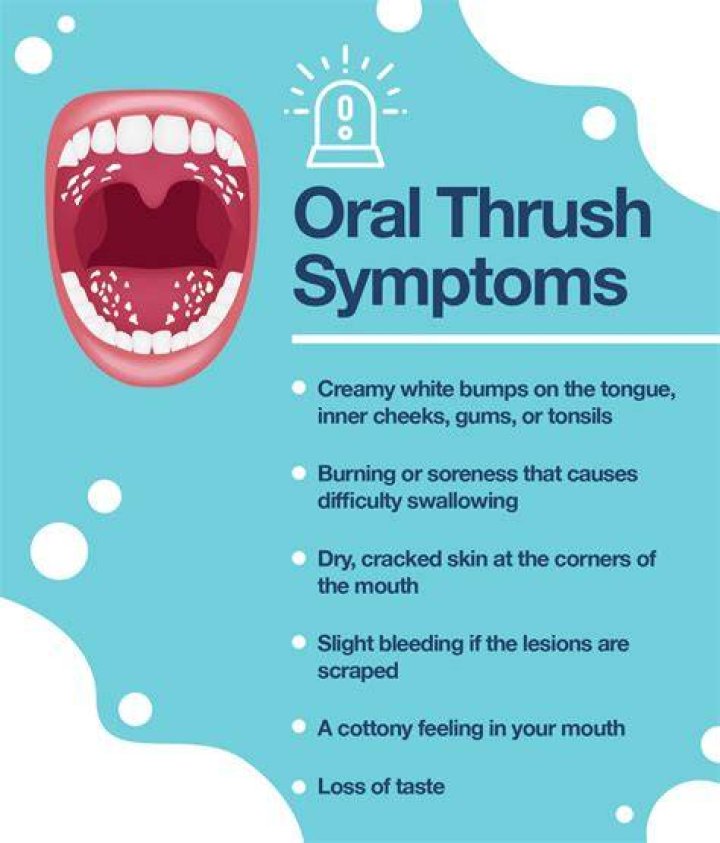 How do you treat oral thrush pain?