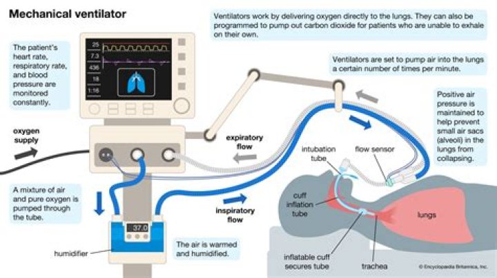 How does PRVC ventilation work