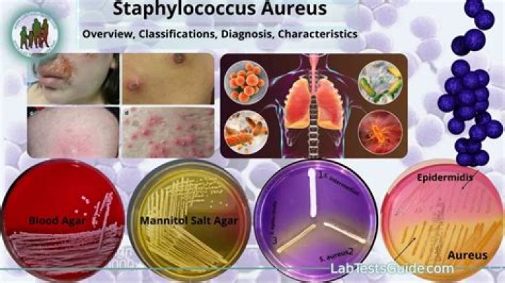 How is Staphylococcus aureus and Staphylococcus epidermidis distinguished