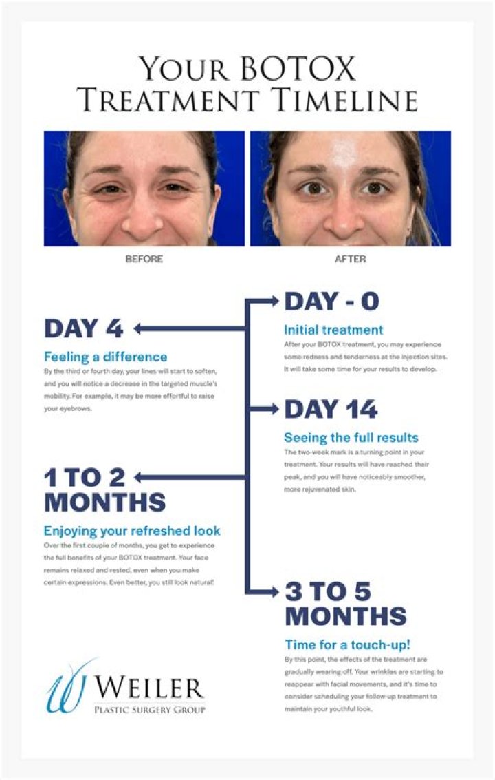 How long does it take for Byetta to start working?