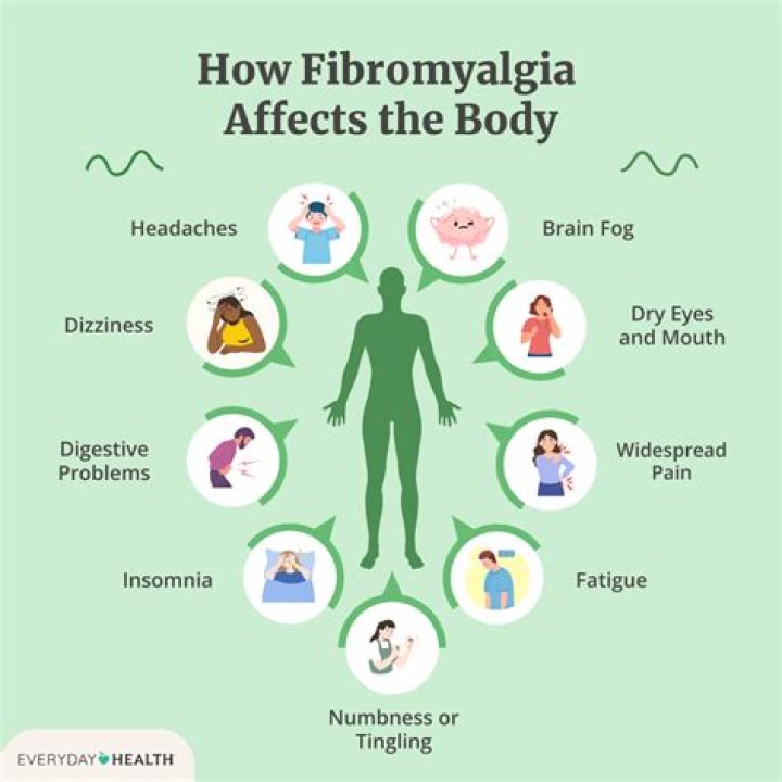 How quickly can fibromyalgia develop