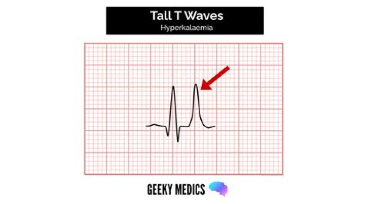 How tall is a trellis