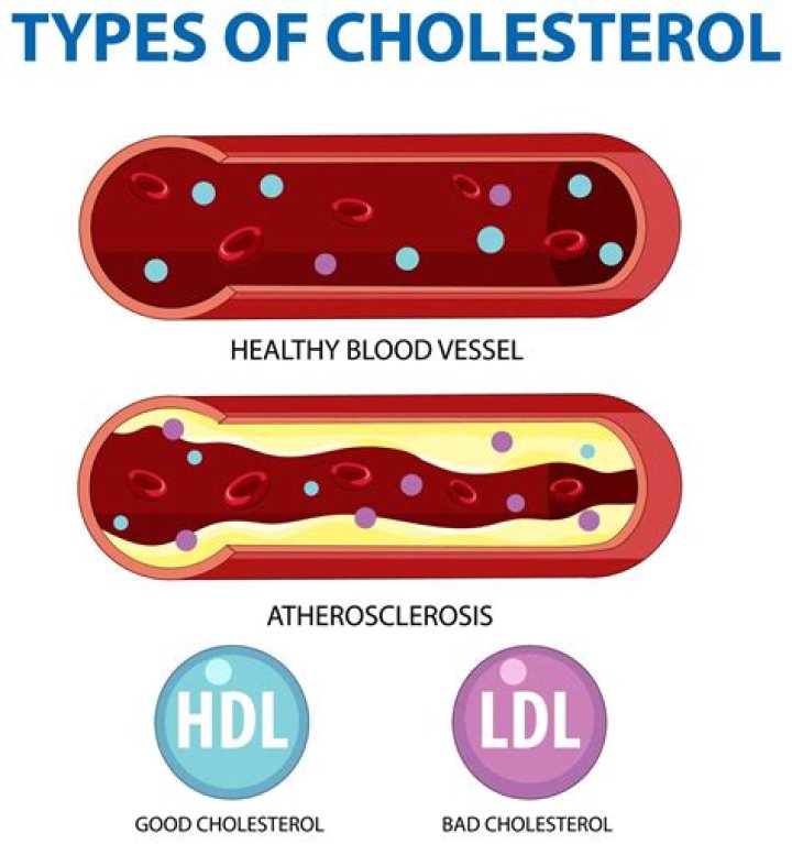 Is mozzarella bad for cholesterol?