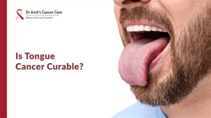 Is PBFD curable