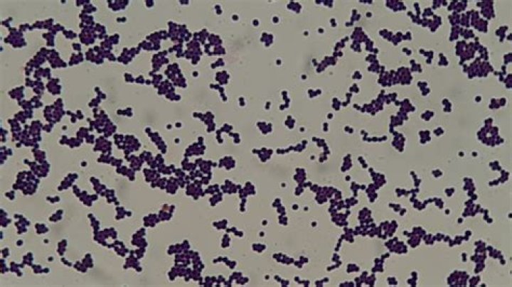 Is Staphylococcus epidermidis the same as Staphylococcus aureus