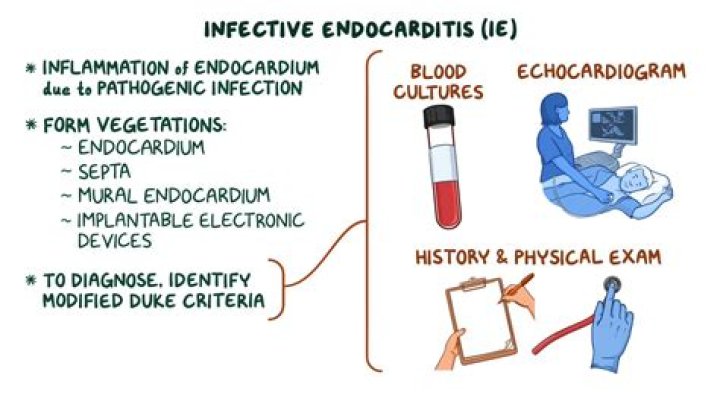 Is there a rash with endocarditis?