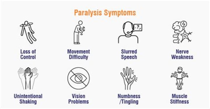 What causes descending paralysis