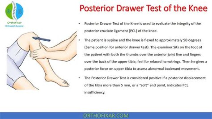 What does a positive drawer test indicate?