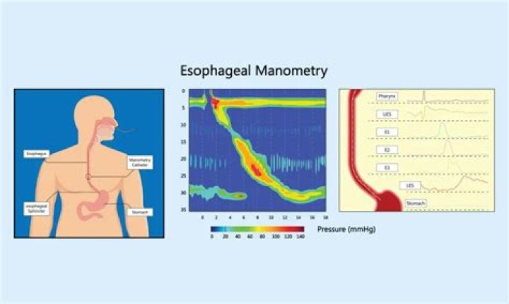 What does anorectal manometry test for?