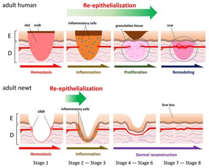 What does epithelialization mean