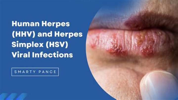 What does HHV 6a cause?