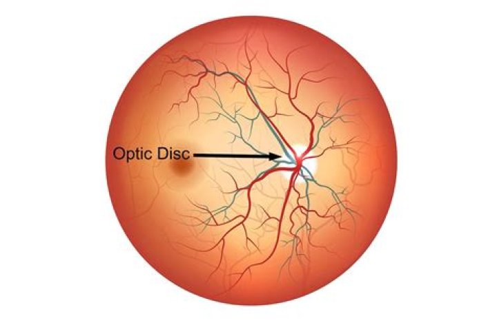 What is a CQB optic?