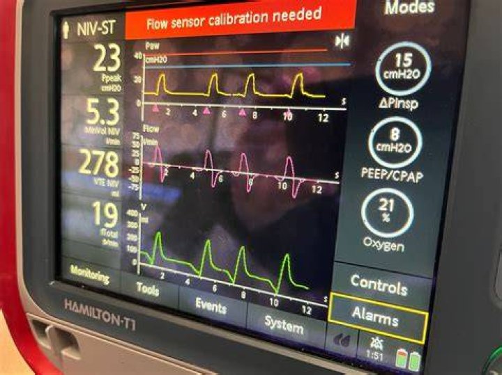 What is Aprv mode