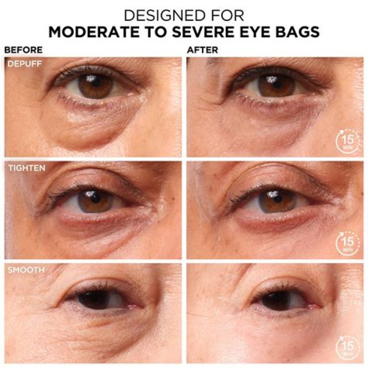What is Eyebag makeup?