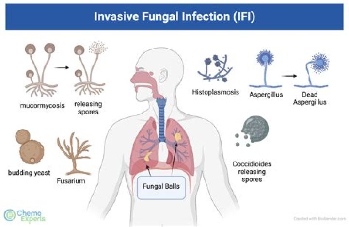 What is invasive Aspergillus?