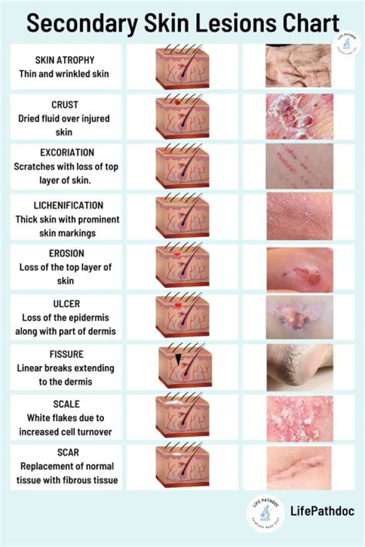 What is lesion studies