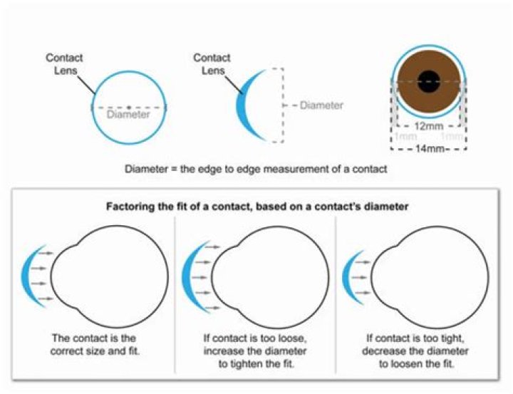 What is normal contact diameter?