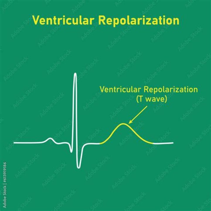What is ventricular repolarization