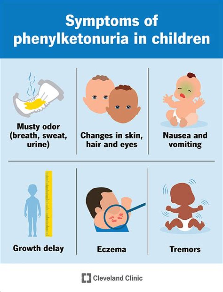 When was PKU test developed