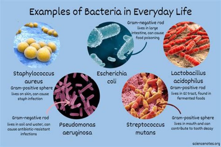 Why are some bacteria Unculturable