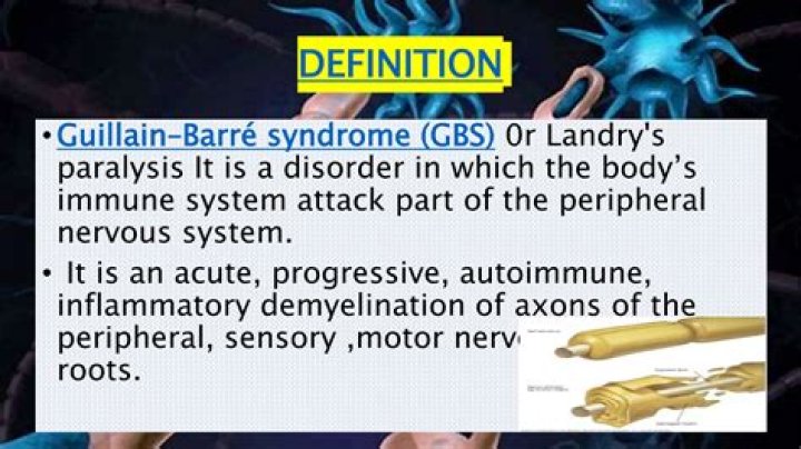 Why does demyelination occur in Guillain Barré syndrome